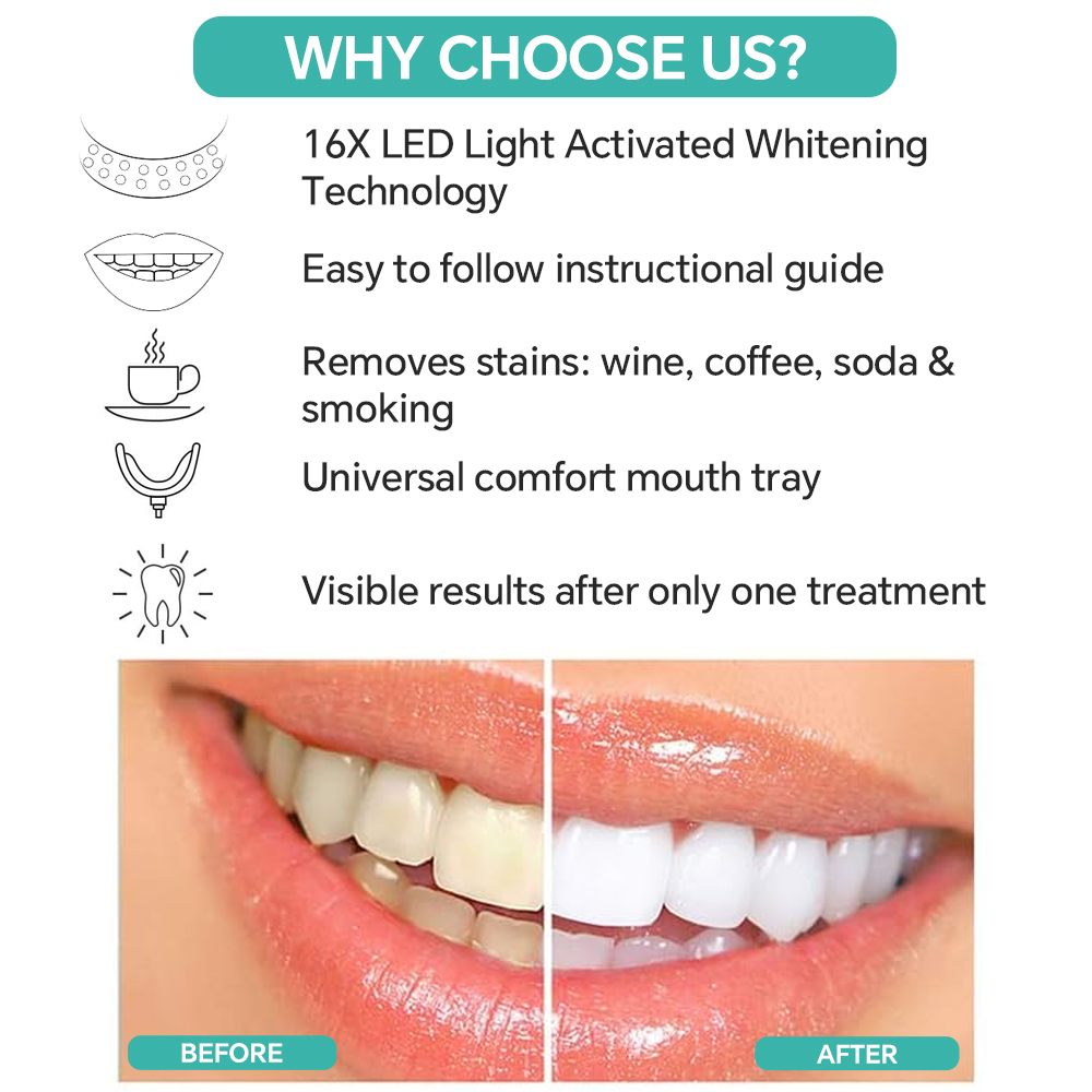 Teeth Whitening Enhancer Light - đánh giá và giá Led Mouth Tray