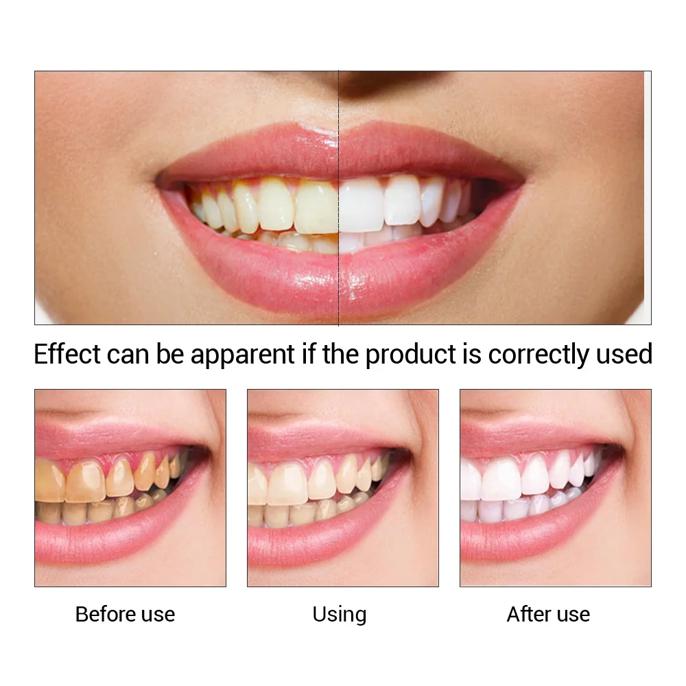 FTEENPLY Làm Trắng Răng Tinh C - đánh giá và giá Teeth Whitening Instant