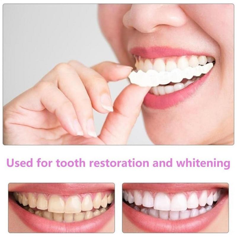 Snap On Teeth Veneers Instant  - đánh giá và giá Teeth Whitening Instant