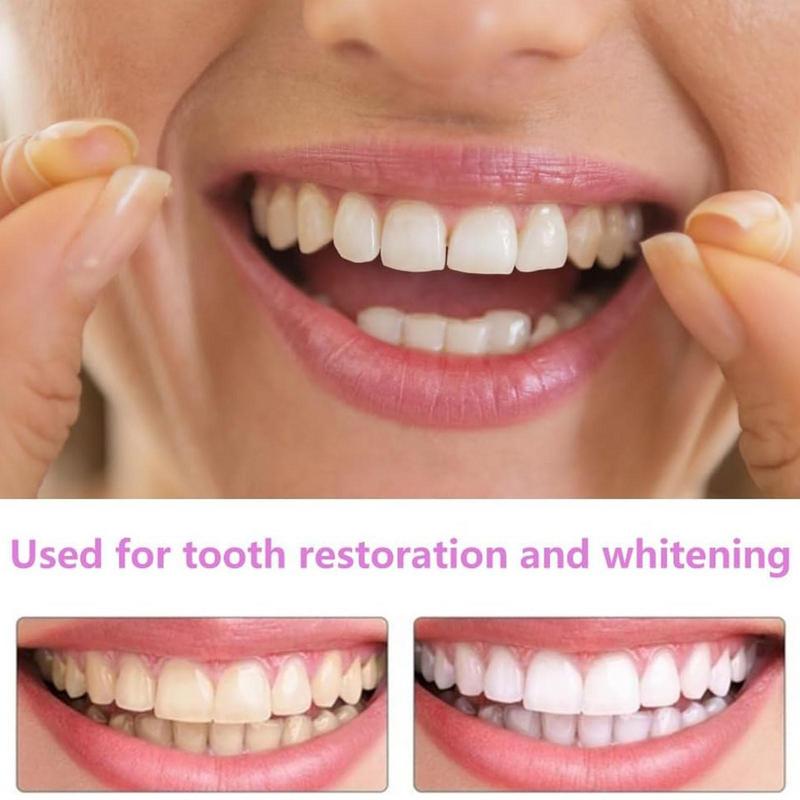Snap On Teeth Veneers Instant  - đánh giá và giá Teeth Whitening Instant