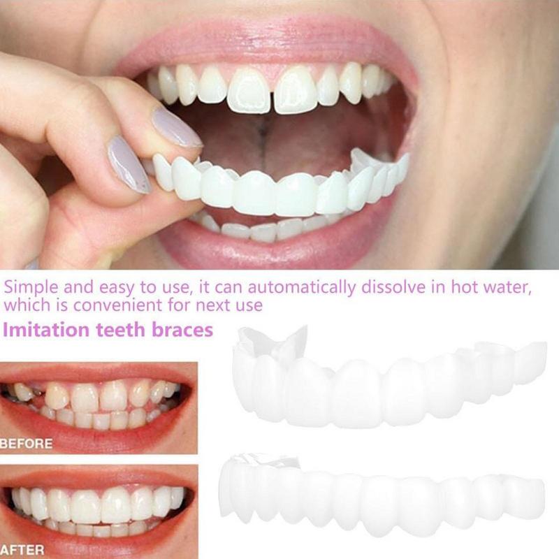 Snap On Teeth Veneers Instant  - đánh giá và giá Teeth Whitening Instant