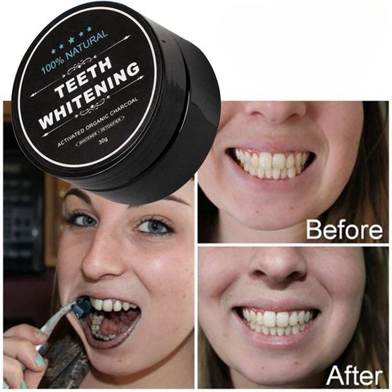 1 Box Activated Charcoal Teeth - đánh giá và giá Teeth Whitening Charcoal