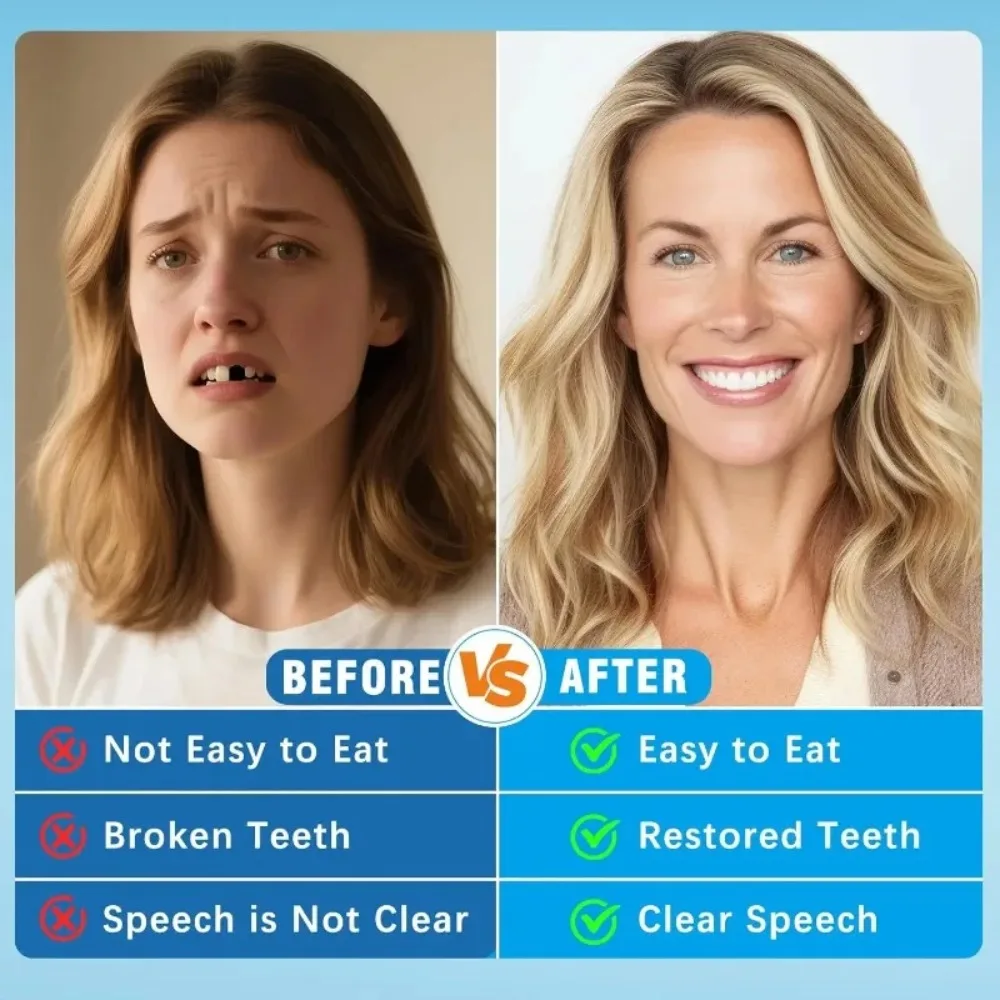 Full Set Dentures Fake Teeth B - đánh giá và giá Teeth Whitening Instant