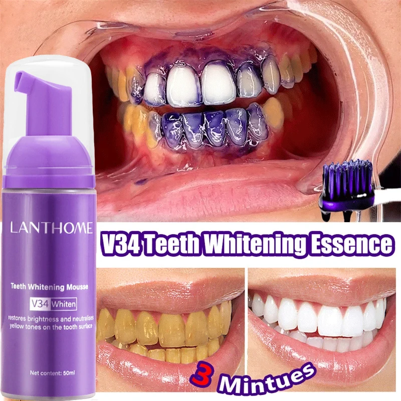 V34 Teeth Whitening Mousse Too - đánh giá và giá Teeth Whitening Xylitol