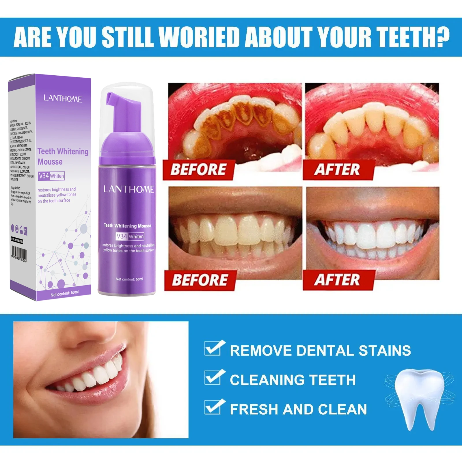 V34 Teeth Whitening Mousse Too - đánh giá và giá Teeth Whitening Xylitol